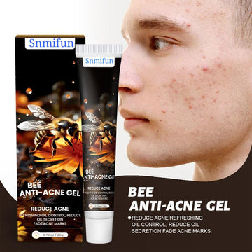Bee Anti-Acne Gel (Original